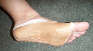 taping feet for pain