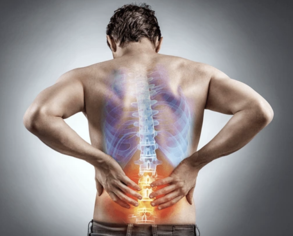 Back_pain_coloures_spine